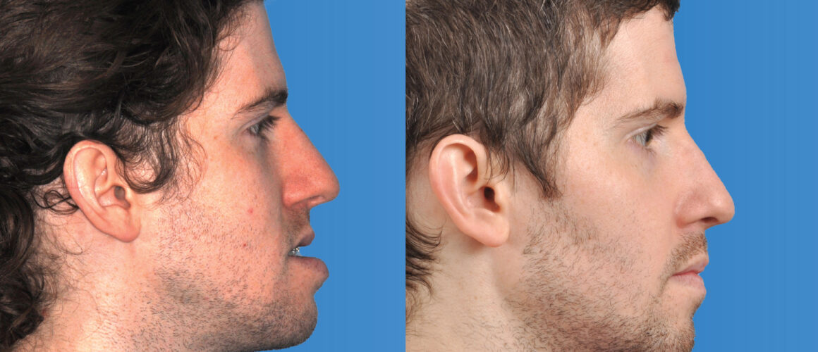 Gareth Featured Image