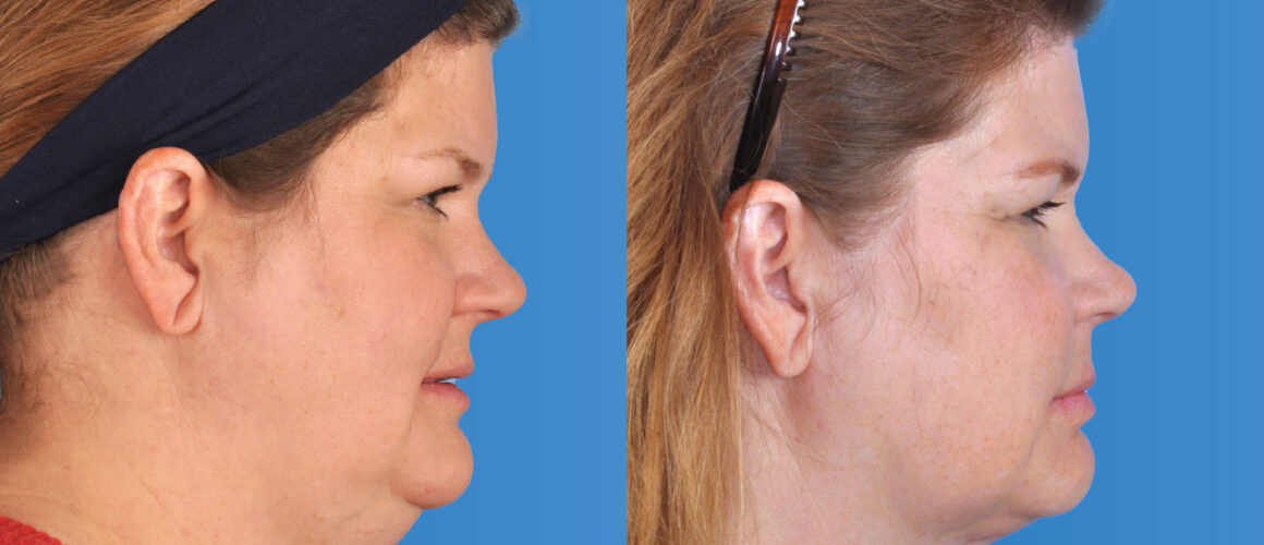 Gerri Anne Featured Image