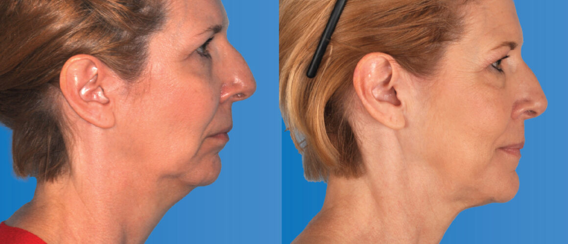 Kathy Featured Image