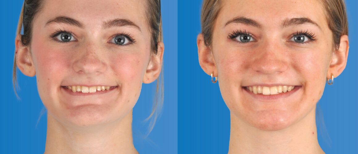 Logan Featured Image