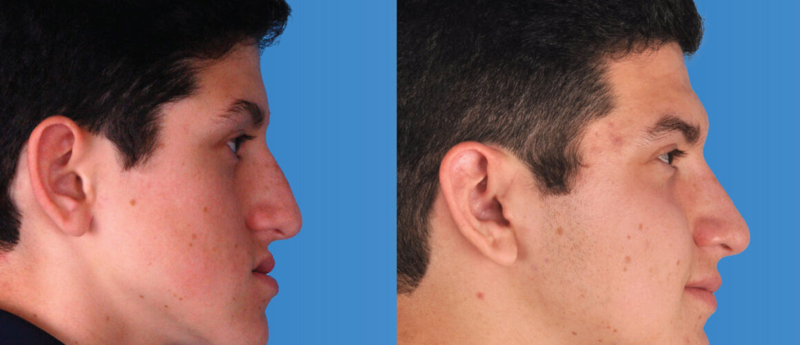 Tyler Featured Image