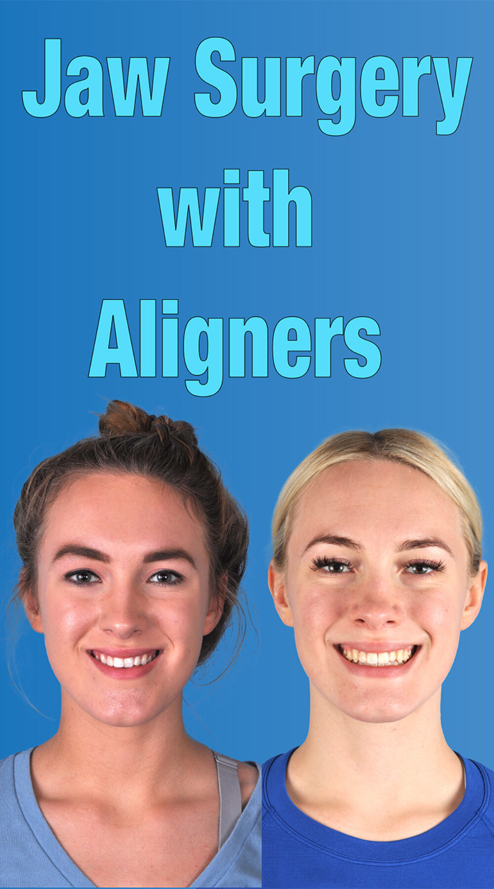 Jaw Surgery with Aligners Cover Art