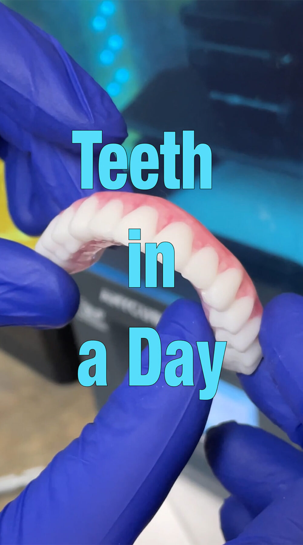 Teeth in a Day