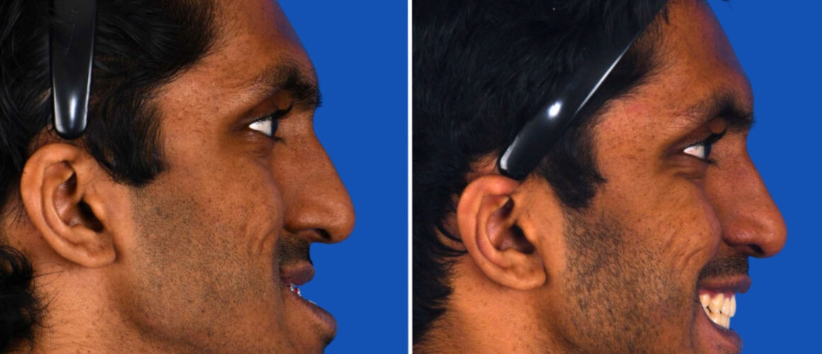 Aravind_FeaturedImage