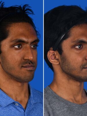 Aravind_QuarterImage