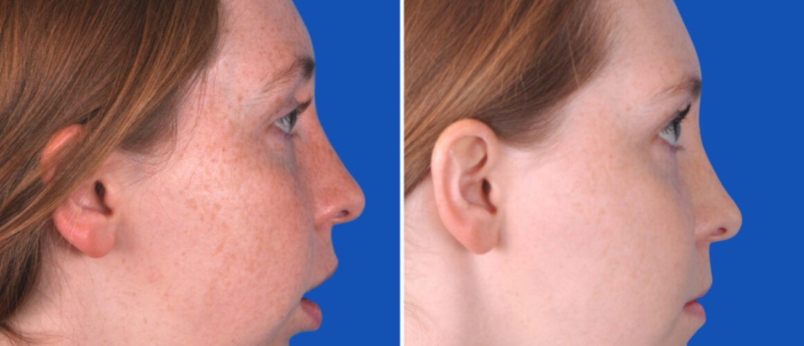 Michelle_FeaturedImage