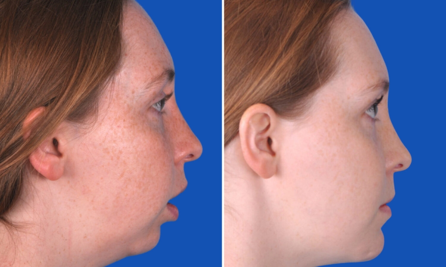 Michelle_FeaturedImage