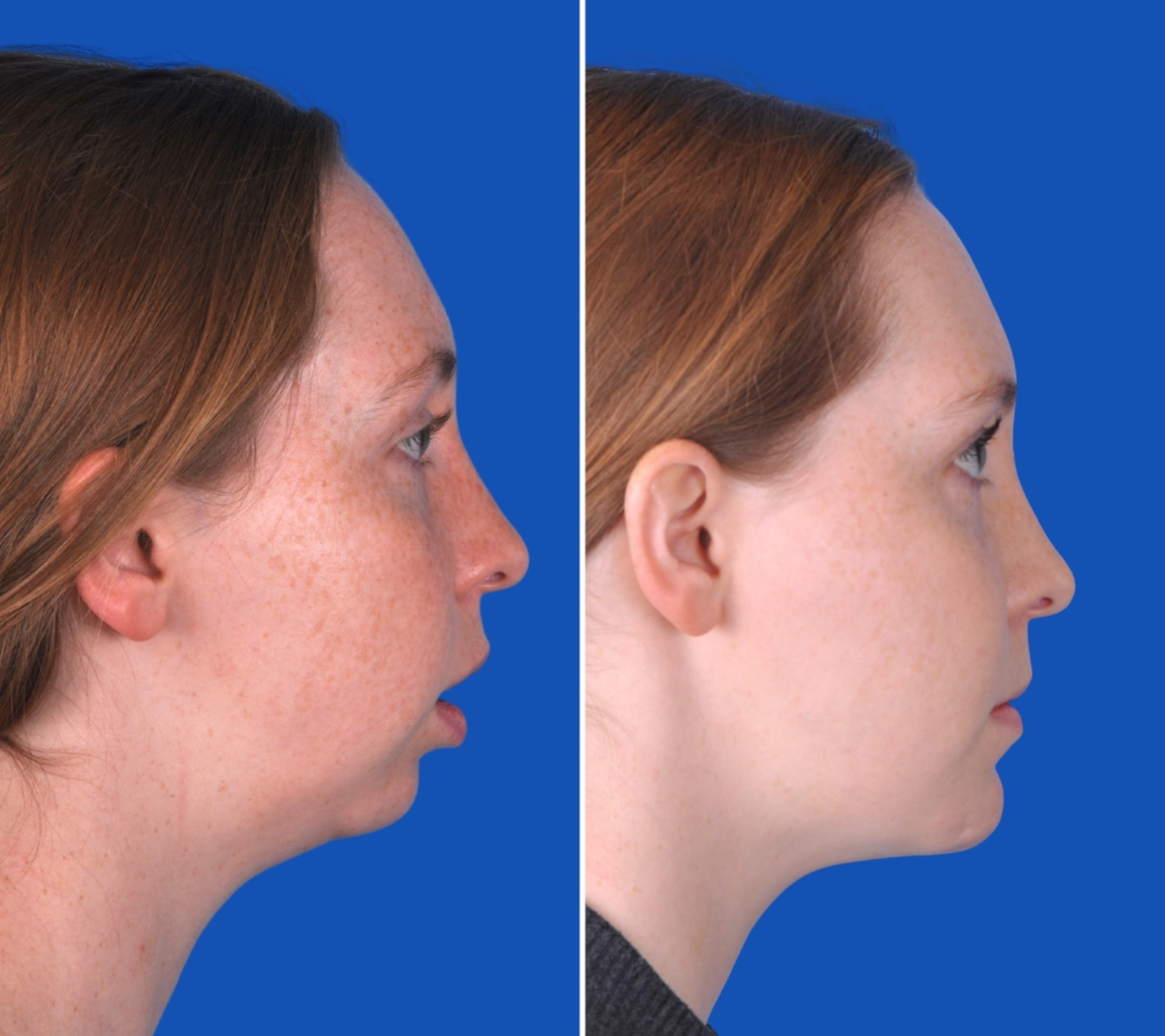 Michelle_FeaturedImage