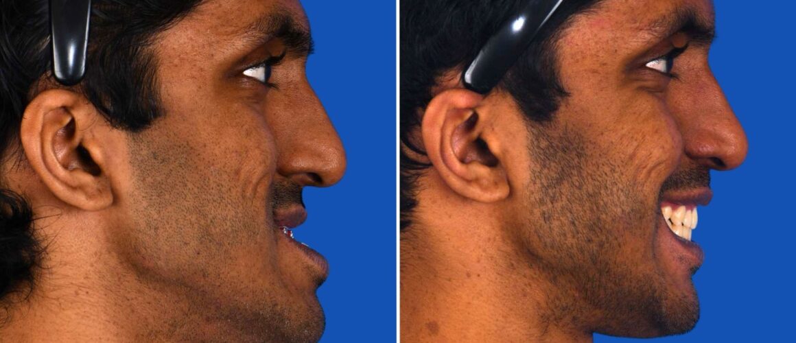 WEBSITE Featured Images_Aravind