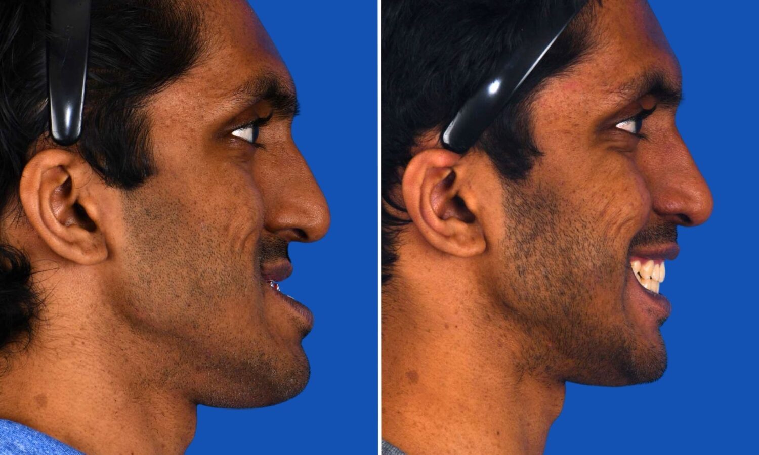 WEBSITE Featured Images_Aravind