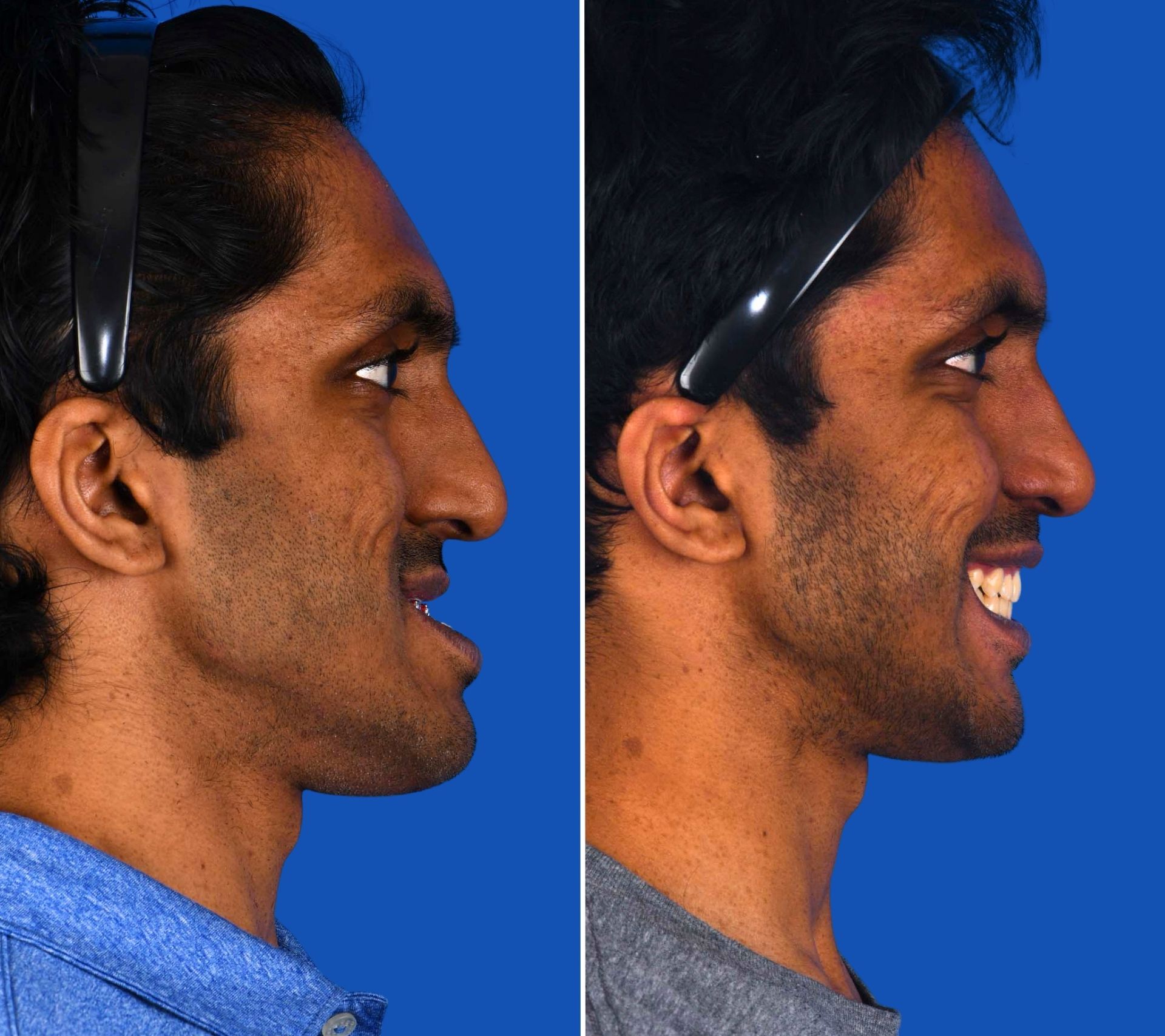 WEBSITE Featured Images_Aravind