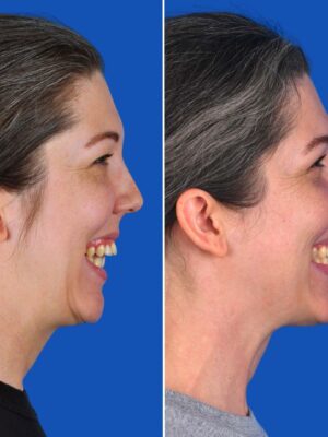 Morrison_SideImage_Smile