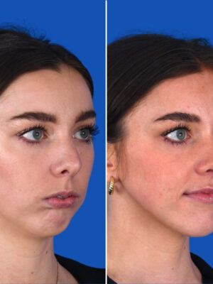Claire_SideProfile
